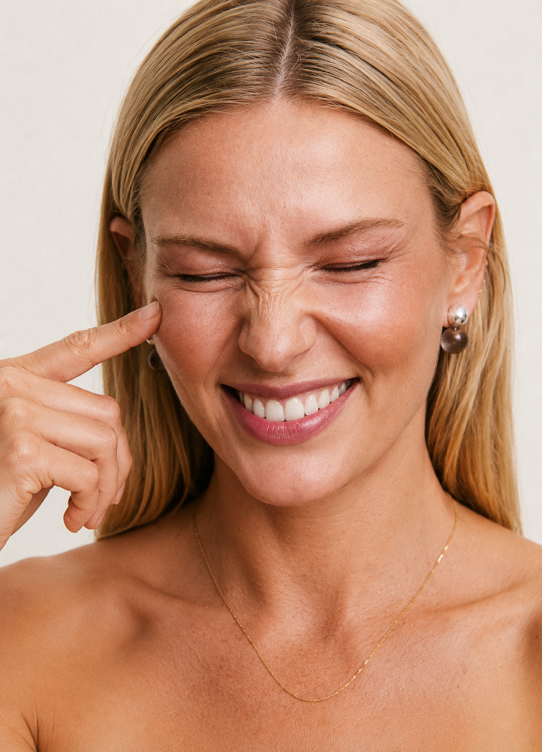 Botox 2 zonas con Dysport