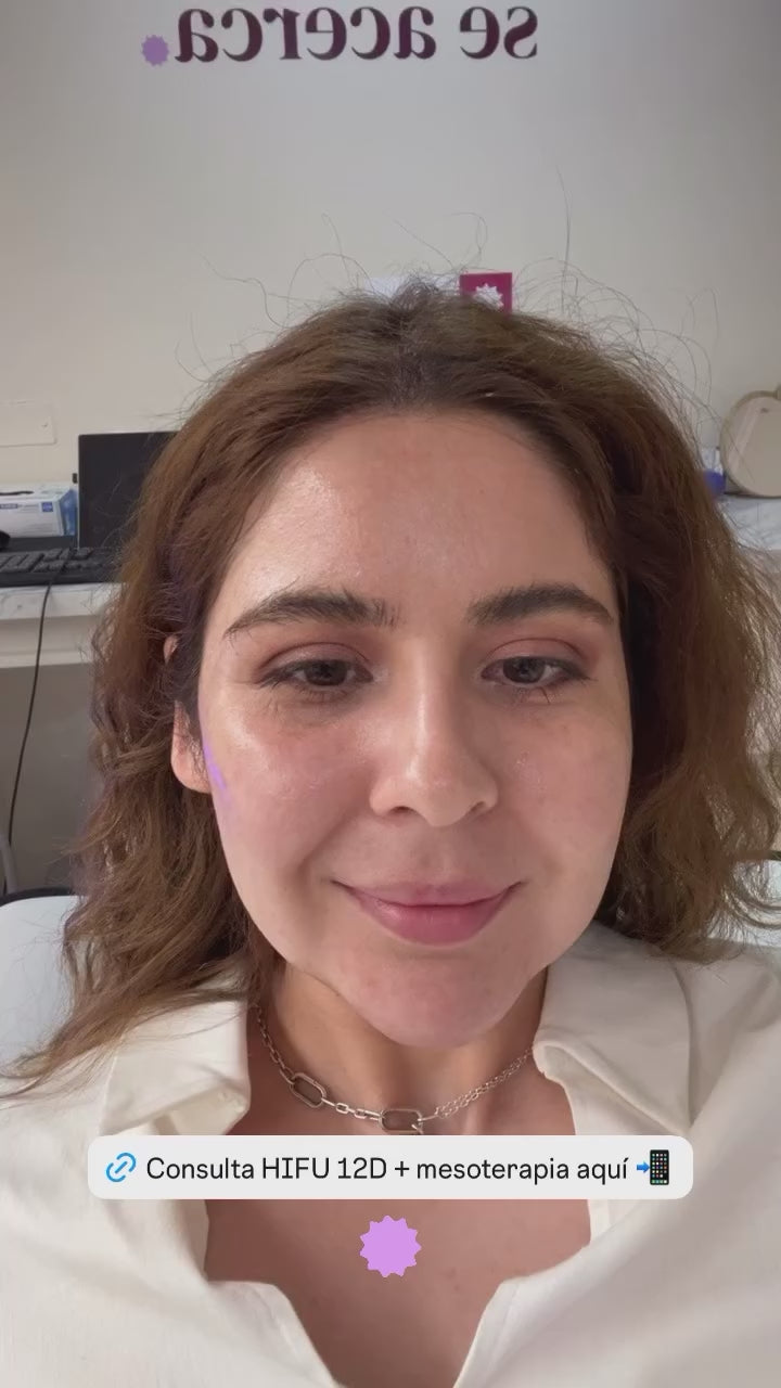 Pack Glow & Lift | HIFU 12D Facial con Mesoterapia Julant PDRN